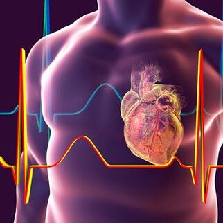 Heart syndrome with cervical osteochondrosis