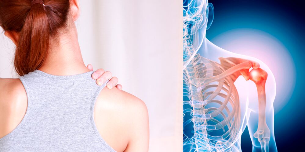 The development of shoulder osteoarthritis gradually leads to constant pain