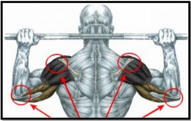 The load on the shoulder and elbow muscles is one of the causes of arthrosis of the shoulder joint. 