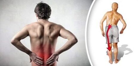 Pain syndrome with the pawnbar osteocondrosis ranks legs