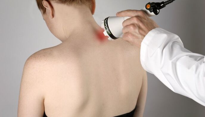 Laser therapy for cervical osteochondrosis